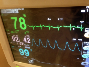 看護必要度 Hファイル A項目 心電図モニター